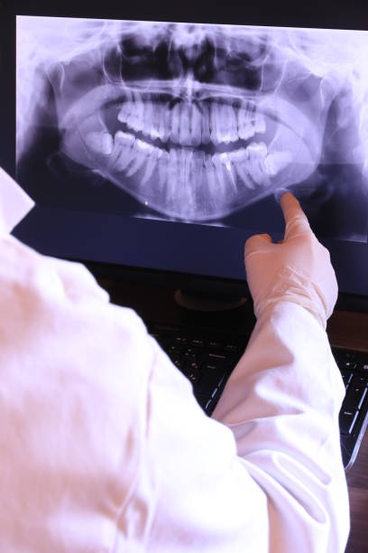 Best Broken or Chipped Tooth Repair in Miramar Beach, FL